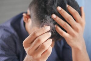 Haarausfall durch Schilddrüsenerkrankung